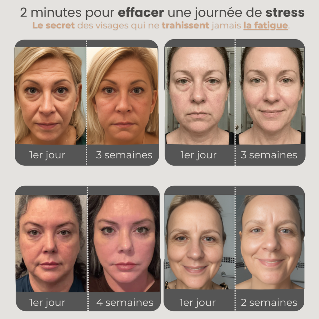 L'Expert Sculpt - Brosse de Drainage Lymphatique pour visage