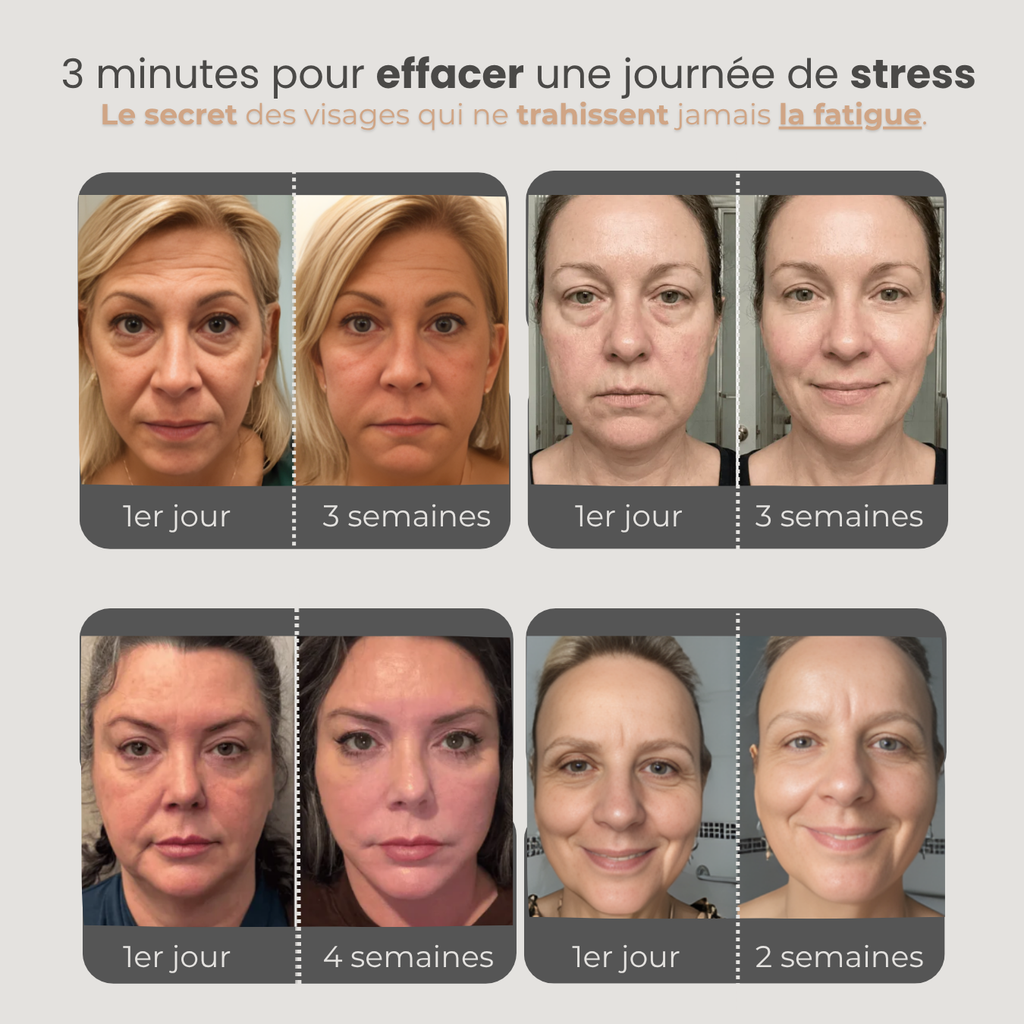 L'Expert Sculpt - Brosse de Drainage Lymphatique pour visage