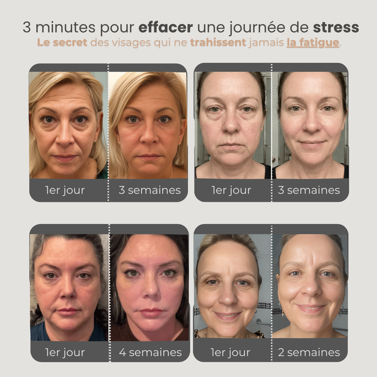 L'Expert Sculpt - Brosse de Drainage Lymphatique pour visage